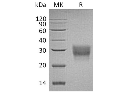 Recombinant Human CD8 beta/CD8B Protein (His Tag) - ABMIUM