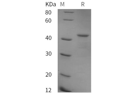 SDS-PAGE analysis of Human ATXN2 proteins, 2 μg/lane of Recombinant Human ATXN2 proteins was resolved with SDS-PAGE under reducing conditions, showing bands at 42 kDa.