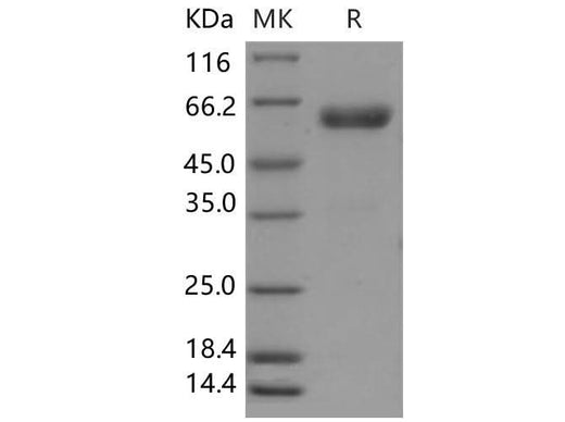 Recombinant Mouse CHODL/Chondrolectin Protein (Fc Tag) - ABMIUM