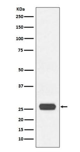 Anti-GST-Tag Rabbit Monoclonal Antibody Boster Bio