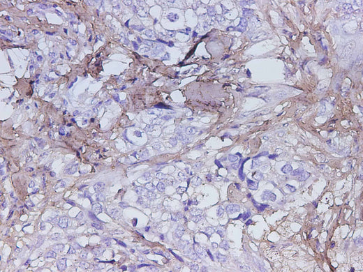 Anti-Human POSTN Antibody - ABMIUM