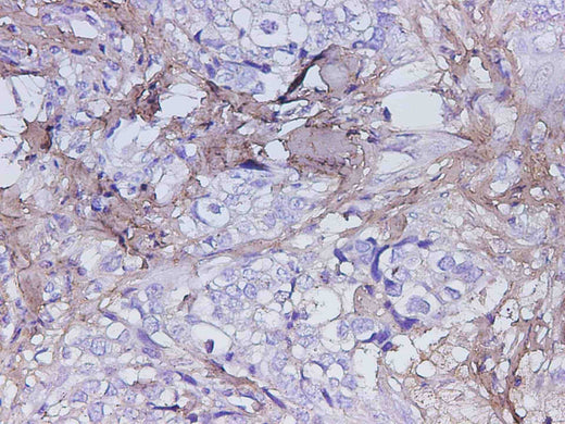 Anti-Human POSTN Antibody