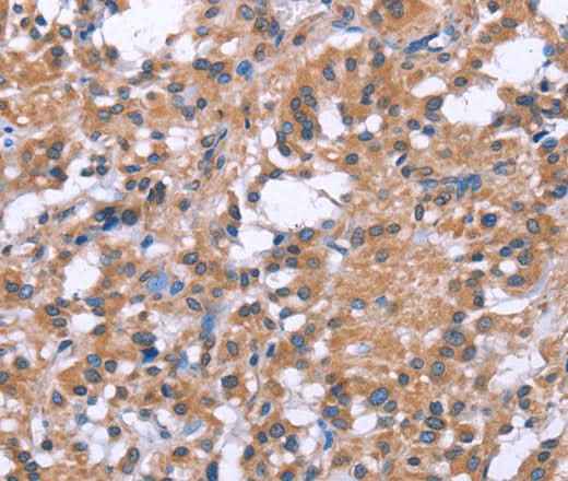Anti-Human GPR172B Antibody