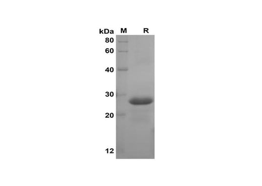 SDS-PAGE analysis of Human CXCL2 proteins, 2 μg/lane of Recombinant Human CXCL2 proteins was resolved with SDS-PAGE under reducing conditions, showing bands at 28 kDa.