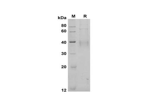SDS-PAGE analysis of Human CD30 Ligand/TNFSF8 proteins, 2 μg/lane of Recombinant Human CD30 Ligand/TNFSF8 proteins was resolved with SDS-PAGE under reducing conditions, showing bands at 40 kDa.