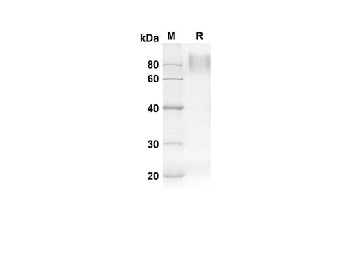SDS-PAGE analysis of Human GPNMB proteins, 2 μg/lane of Recombinant Human GPNMB proteins was resolved with an SDS-PAGE under reducing conditions, showing bands at 50.9 kDa.