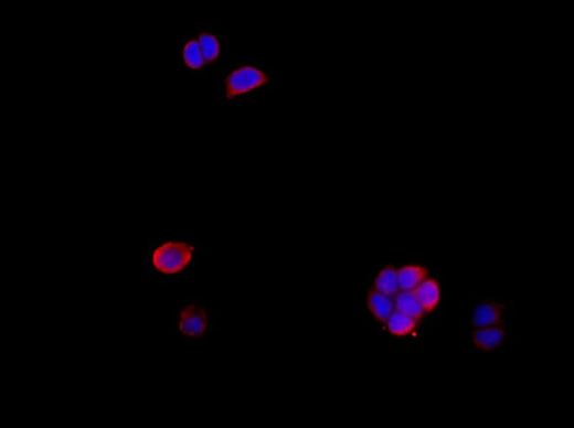 Anti-Human Amphiregulin Antibody - ABMIUM