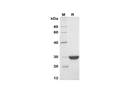 SDS-PAGE analysis of Human β-Casein/CSN2 proteins, 2 μg/lane of Recombinant Human β-Casein/CSN2 proteins was resolved with SDS-PAGE under reducing conditions, showing bands at 30 kDa.