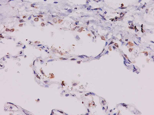 Anti-Human CCL11 Antibody - ABMIUM