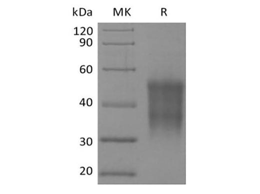 Recombinant Rhesus Macaque CD47/IAP/OA3 (N-6His-Flag) - ABMIUM