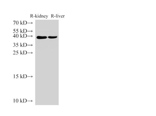 Anti-Human AMACR Antibody - ABMIUM