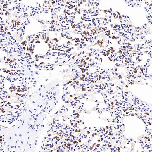 Immunohistochemistry analysis of paraffin-embedded mouse inflammatory lung using MMP9 Monoclonal Antibody at dilution of 1:400.