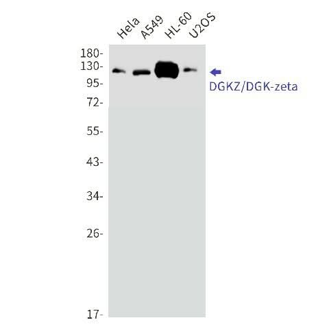 Western blot detection of DGKZ/DGK-zeta in Hela,A549,HL-60,U2OS cell lysates using DGKZ/DGK-zeta Rabbit mAb(1:1000 diluted).Predicted band size:104kDa.Observed band size:124,114kDa.