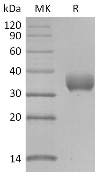 Recombinant SARS-CoV-2 Spike RBD (R408I)(His Tag) - ABMIUM