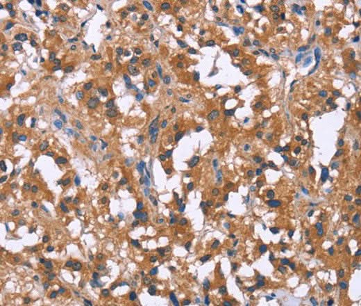 Anti-Human GPR172B Antibody - ABMIUM