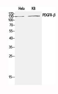 Anti-Human/Mouse/Rat PDGFRB Antibody