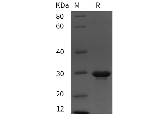 SDS-PAGE analysis of Rat NT-proBNP proteins, 2 μg/lane of Recombinant Rat NT-proBNP proteins was resolved with SDS-PAGE under reducing conditions, showing bands at 30 kDa.