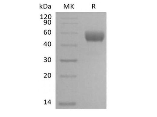Recombinant Mouse NKG2-D type II Integral Membrane Protein/NKG2D/CD314 (N-Fc) - ABMIUM