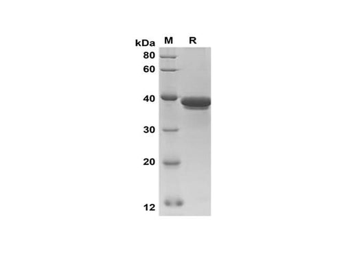 SDS-PAGE analysis of Human Rock-2 proteins, 2 μg/lane of Recombinant Human Rock-2 proteins was resolved with SDS-PAGE under reducing conditions, showing bands at 38 kDa.