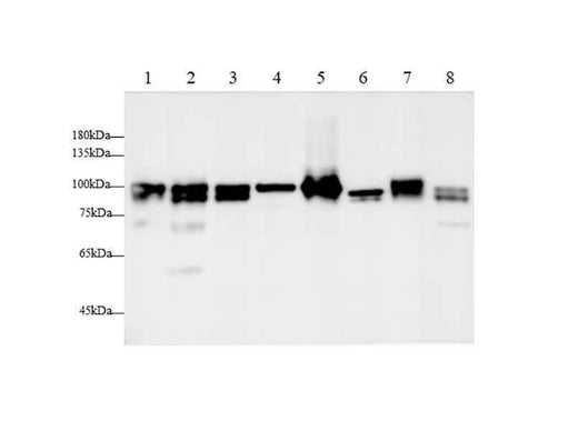 Anti-Human/Mouse/Rat CANX Antibody - ABMIUM