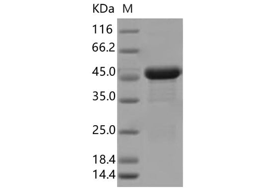 Recombinant SARS-CoV-2 N Protein (I292T)(His Tag) - ABMIUM
