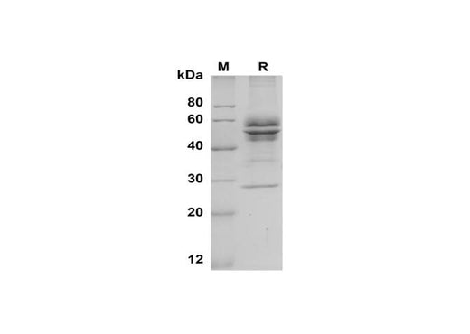 SDS-PAGE analysis of Human IGFBP6 proteins, 2 μg/lane of Recombinant Human IGFBP6 proteins was resolved with SDS-PAGE under reducing conditions, showing bands at 50-60 kDa.