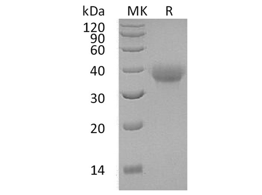 Recombinant Human OX40/TNFRSF4 Protein (His Tag) - ABMIUM