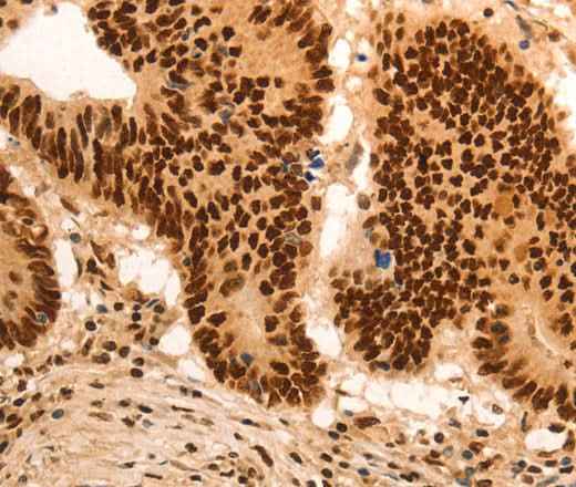 Anti-Human E2F7 Antibody