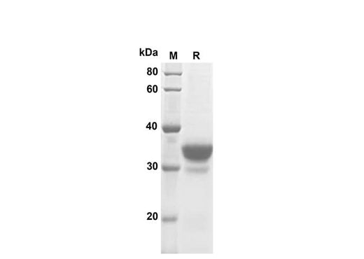 SDS-PAGE analysis of Mouse IL-3 proteins, 2 μg/lane of Recombinant Mouse IL-3 proteins was resolved with SDS-PAGE under reducing conditions, showing bands at 35 kDa.