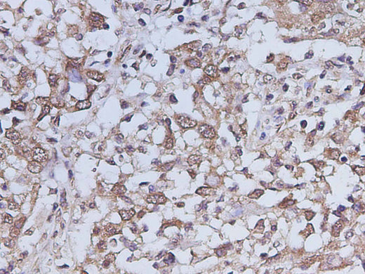 Anti-Human IL-17A Antibody - ABMIUM