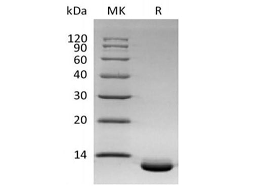 Recombinant Human C-X-C Motif Chemokine 6/CXCL6 (C-6His) - ABMIUM