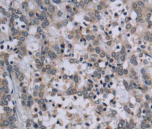 Anti-Human TP53AIP1 Antibody