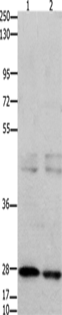 Anti-Human/Mouse GNRHR Antibody - ABMIUM