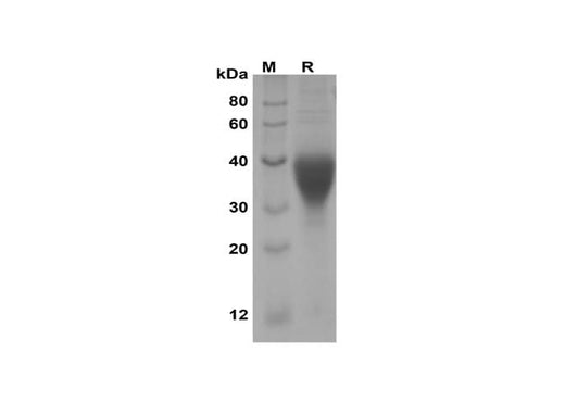 SDS-PAGE analysis of Human LIF proteins, 2 μg/lane of Recombinant Human LIF proteins was resolved with SDS-PAGE under reducing conditions, showing bands at 30-40 kDa.