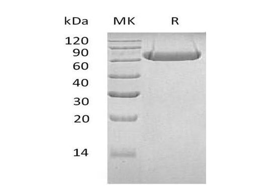 Recombinant Human LAG3/CD223 Protein (His Tag) - ABMIUM