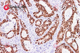 Polymer-HRP Anti-Mouse/Rabbit IHC Detection System(DAB solution) - ABMIUM