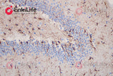 Polymer-HRP Anti-Mouse/Rabbit IHC Detection System(DAB solution) - ABMIUM