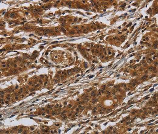 Anti-Human GATA5 Antibody