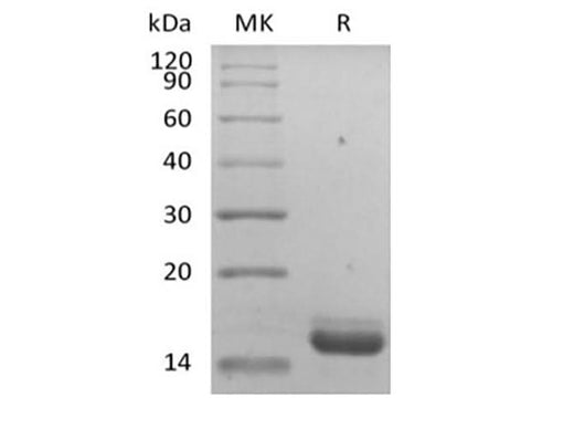 Recombinant Human IL-36 Receptor Antagonist Protein/IL-36RN/IL-1F5 - ABMIUM