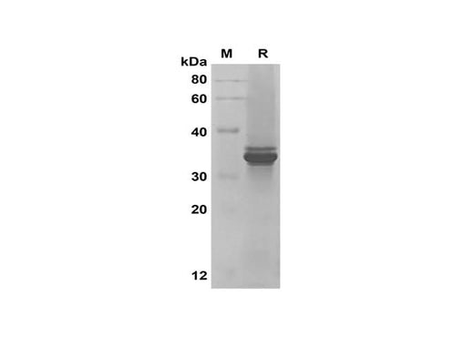 SDS-PAGE analysis of Human IL-33 proteins, 2 μg/lane of Recombinant Human IL-33 proteins was resolved with SDS-PAGE under reducing conditions, showing bands at 33 kDa.