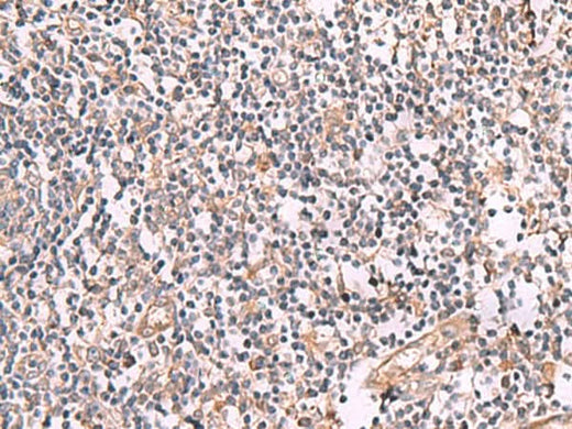 Immunohistochemistry of paraffin-embedded Human tonsil tissue using SLC12A5 Polyclonal Antibody at dilution of 1:50(×200)
