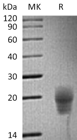 Recombinant Cynomolgus CTLA-4/CD152 Protein (His Tag) - ABMIUM