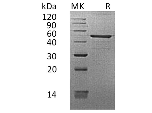 Recombinant Human REG3G/PAP-1B Protein (Fc Tag) - ABMIUM