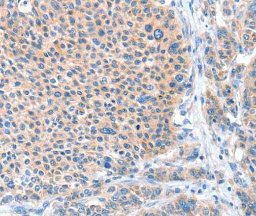Anti-Human ADAM20 Antibody