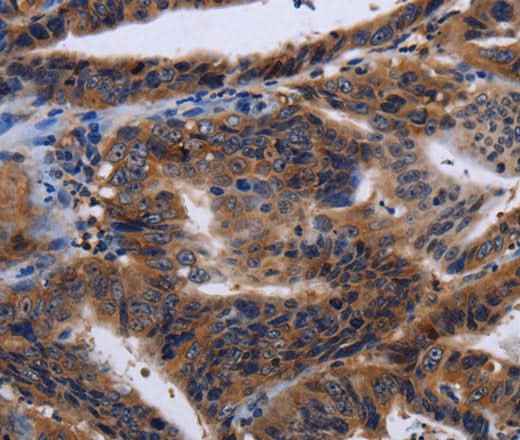 Anti-Human HTR2B Antibody