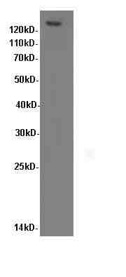 Anti-Human Integrin beta 1 Antibody