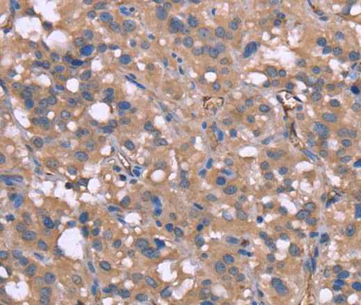 Anti-Human HP Antibody