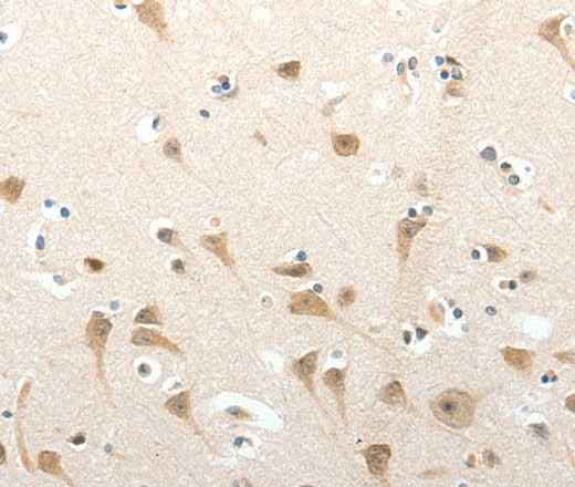 Anti-Human/Mouse SEMA3D Antibody