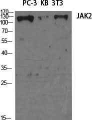 Anti-Human/Mouse/Rat JAK2 Antibody