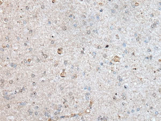 Immunohistochemistry of paraffin-embedded Human brain tissue using RAB4A Polyclonal Antibody at dilution of 1:40(×200)